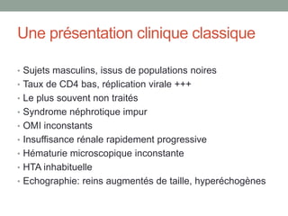 Une présentation clinique classique
• Sujets masculins, issus de populations noires
• Taux de CD4 bas, réplication virale +++
• Le plus souvent non traités
• Syndrome néphrotique impur
• OMI inconstants
• Insuffisance rénale rapidement progressive
• Hématurie microscopique inconstante
• HTA inhabituelle
• Echographie: reins augmentés de taille, hyperéchogènes
 
