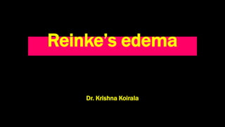 Reinke’s edema
Dr. Krishna Koirala
 