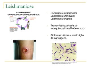 Leishmaniose Leishmania brasiliensis, Leishmania donovani, Leishmania tropica Transmissão: picada do mosquito palha ( Phebotomus ) Sintomas: úlceras, destruição de cartilagens. 