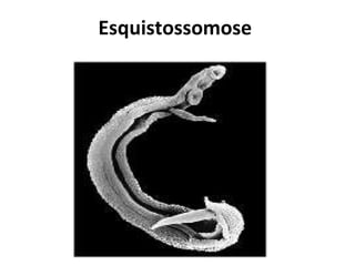 Esquistossomose   