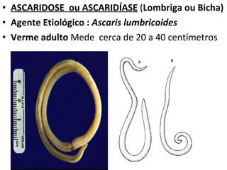 ASCARIDOSE  ou ASCARIDÍASE  ( Lombriga ou Bicha) Agente Etiológico :  Ascaris lumbricoides Verme adulto  Mede  cerca de 20 a 40 centímetros 