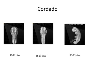 Cordado




19-21 días   21-23 días   23-25 días
 