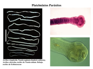 Platelmintos Parásitos Arriba a izquierda, Taenia saginata (lombriz solitaria). Arriba a derecha, escólex de Taenia solium. Debajo, escólex de Echinococcus 