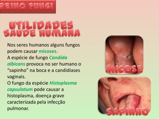 Reino FungiUtilidadesSaúde humanaNos seres humanos alguns fungos podem causar micoses.A espécie de fungo Candidaalbicansprovoca no ser humano o “sapinho” na boca e a candidiases vaginais.O fungo da espécie Histoplasmacapsulatum pode causar a histoplasma, doença grave caracterizada pela infecção pulmonar. MicoseSapinho