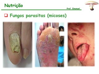 Nutrição
                               Prof. Emanuel



 Fungos parasitas (micoses)
 