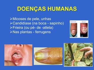 DOENÇAS HUMANAS
Micoses de pele, unhas
Candidíase (na boca - sapinho)
Frieira (ou pé- de -atleta)
Nas plantas - ferrugens
 