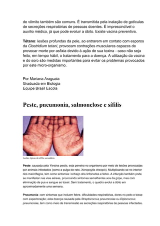 de vômito também são comuns. É transmitida pela inalação de gotículas
de secreções respiratórias de pessoas doentes. É imprescindível o
auxílio médico, já que pode evoluir a óbito. Existe vacina preventiva.
Tétano: lesões profundas da pele, ao entrarem em contato com esporos
da Clostridium tetani, provocam contrações musculares capazes de
provocar morte por asfixia devido à ação de sua toxina - caso não seja
feito, em tempo hábil, o tratamento para a doença. A utilização da vacina
e do soro são medidas importantes para evitar os problemas provocados
por este micro-organismo.

Por Mariana Araguaia
Graduada em Biologia
Equipe Brasil Escola

Peste, pneumonia, salmonelose e sífilis

Lesões típicas da sífilis secundária

Peste: causada pela Yersina pestis, esta penetra no organismo por meio de lesões provocadas
por animais infectados (como a pulga-do-rato, Xenopsylla cheopis). Multiplicando-se no interior
dos macrófagos, tem como sintomas: inchaço dos linfonodos e febre. A infecção também pode
se manifestar nas vias aéreas, provocando sintomas semelhantes aos da gripe, mas com
eliminação de pus e sangue ao tossir. Sem tratamento, o quadro evolui a óbito em
aproximadamente uma semana.
Pneumonia: com sintomas que incluem febre, dificuldades respiratórias, dores no peito e tosse
com expectoração; esta doença causada pela Streptococcus pneumoniae ou Diplococcus
pneumoniae, tem como meio de transmissão as secreções respiratórias de pessoas infectadas.

 