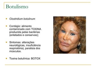 Botulismo Clostridium botulinum Contágio: alimento contaminado com TOXINA produzida pelas bactérias (enlatados e conservas); Sintomas: alterações neurológicas, insuficiência respiratória), paralisia dos músculos. Toxina botulínica: BOTOX 