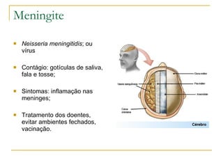 Meningite Neisseria meningitidis ; ou vírus Contágio: gotículas de saliva, fala e tosse; Sintomas: inflamação nas meninges; Tratamento dos doentes, evitar ambientes fechados, vacinação. 