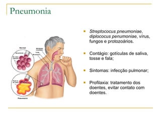 Pneumonia Streptococus pneumoniae ,  diplococus penumoniae , vírus, fungos e protozoários. Contágio: gotículas de saliva, tosse e fala; Sintomas: infecção pulmonar; Profilaxia: tratamento dos doentes, evitar contato com doentes. 