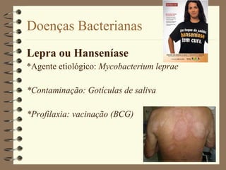 Doenças Bacterianas Lepra ou Hanseníase *Agente etiológico:  Mycobacterium leprae *Contaminação: Gotículas de saliva *Profilaxia: vacinação (BCG) 