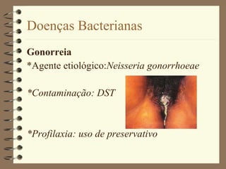 Doenças Bacterianas Gonorreia *Agente etiológico: Neisseria gonorrhoeae *Contaminação: DST *Profilaxia: uso de preservativo 