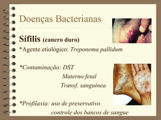Doenças Bacterianas

Sífilis (cancro duro)
*Agente etiológico: Treponema pallidum

*Contaminação: DST
               Materno fetal
              Transf. sanguínea

*Profilaxia: uso de preservativo
             controle dos bancos de sangue
 
