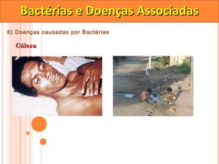 Bactérias e Doenças Associadas
6) Doenças causadas por Bactérias

  Cólera
 