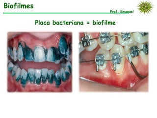 Biofilmes
                                     Prof. Emanuel


            Placa bacteriana = biofilme
 