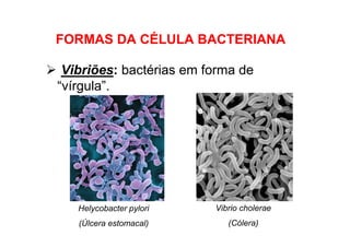 Vibriões: bactérias em forma de
“vírgula”.
FORMAS DA CÉLULA BACTERIANA
Helycobacter pylori
(Úlcera estomacal)
Vibrio cholerae
(Cólera)
 