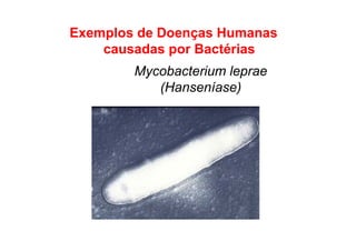 Exemplos de Doenças Humanas
causadas por Bactérias
Mycobacterium leprae
(Hanseníase)
 