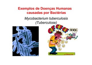 Exemplos de Doenças Humanas
causadas por Bactérias
Mycobacterium tuberculosis
(Tuberculose)
 
