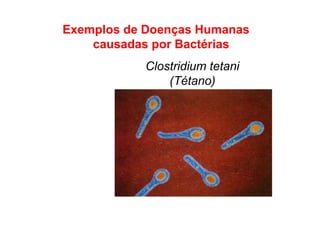 Exemplos de Doenças Humanas
causadas por Bactérias
Clostridium tetani
(Tétano)
 