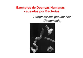 Exemplos de Doenças Humanas
causadas por Bactérias
Streptococcus pneumoniae
(Pneumonia)
 