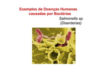 Exemplos de Doenças Humanas
causadas por Bactérias
Salmonella sp.
(Disenterias)
 