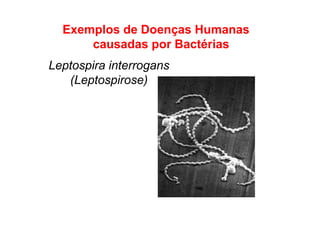 Exemplos de Doenças Humanas
causadas por Bactérias
Leptospira interrogans
(Leptospirose)
 