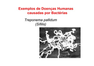 Exemplos de Doenças Humanas
causadas por Bactérias
Treponema pallidum
(Sífilis)
 