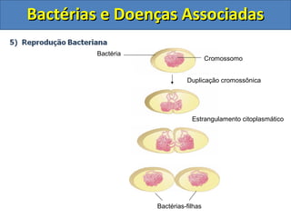 Bactérias e Doenças AssociadasBactérias e Doenças Associadas
Bactérias-filhas
Estrangulamento citoplasmático
Duplicação cromossônica
Cromossomo
Bactéria
 