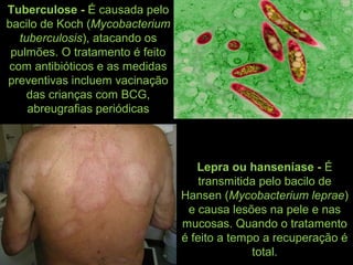 Tuberculose - É causada pelo
bacilo de Koch (Mycobacterium
tuberculosis), atacando os
pulmões. O tratamento é feito
com antibióticos e as medidas
preventivas incluem vacinação
das crianças com BCG,
abreugrafias periódicas
Lepra ou hanseníase - É
transmitida pelo bacilo de
Hansen (Mycobacterium leprae)
e causa lesões na pele e nas
mucosas. Quando o tratamento
é feito a tempo a recuperação é
total.
 