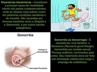 Disenterias bacterianas - Constituem
a principal causa de mortalidade
infantil nos países subdesenvolvidos,
onde as classes mais pobres vivem
em péssimas condições sanitárias e
de moradia. São causadas por
diversas bactérias como a Shigella e
a Salmonella, e por outros bacilos
patogênicos.
Gonorréia ou blenorragia - É
causada por uma bactéria, o
Gonococo (Neisseria gonorrheage),
transmitida por contato sexual.
Provoca ardência, corrimentos pela
uretra. Seu tratamento deve ser feito
sob orientação médica pois exige o
emprego de antibióticos.
 