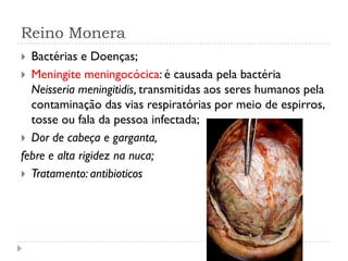 Reino Monera
 Bactérias e Doenças;
 Meningite meningocócica: é causada pela bactéria
Neisseria meningitidis, transmitidas aos seres humanos pela
contaminação das vias respiratórias por meio de espirros,
tosse ou fala da pessoa infectada;
 Dor de cabeça e garganta,
febre e alta rigidez na nuca;
 Tratamento: antibioticos
 