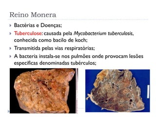 Reino Monera
 Bactérias e Doenças;
 Tuberculose: causada pela Mycobacterium tuberculosis,
conhecida como bacilo de koch;
 Transmitida pelas vias respiratórias;
 A bacteria instala-se nos pulmões onde provocam lesões
especificas denominadas tubérculos;
 