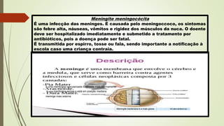 Meningite meningocócita
É uma infecção das meninges. É causada pelo meningoccoco, os sintomas
são febre alta, náuseas, vômitos e rigidez dos músculos da nuca. O doente
deve ser hospitalizado imediatamente e submetido a tratamento por
antibióticos, pois a doença pode ser fatal.
É transmitida por espirro, tosse ou fala, sendo importante a notificação à
escola caso uma criança contraia.
meninge mais externa
é uma membrana vascularizada localizada mais internamente
é uma membrana serosa e está em posição mediana
Meningite bacteriana é a mais grave.
 