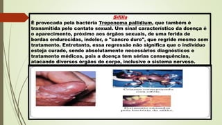 Sífilis
É provocada pela bactéria Treponema pallidium, que também é
transmitida pelo contato sexual. Um sinal característico da doença é
o aparecimento, próximo aos órgãos sexuais, de uma ferida de
bordas endurecidas, indolor, o "cancro duro", que regride mesmo sem
tratamento. Entretanto, essa regressão não significa que o indivíduo
esteja curado, sendo absolutamente necessários diagnósticos e
tratamento médicos, pois a doença tem sérias consequências,
atacando diversos órgãos do corpo, inclusive o sistema nervoso.
 