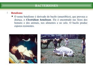  Botulismo
 O nome botulismo é derivado do bacilo (anaeróbico), que provoca a
doença, o Clostridium botulinum. Ele é encontrado nas fezes dos
homens e dos animais, nos alimentos e no solo. O bacilo produz
esporos resistentes.
BACTERIOSES
 
