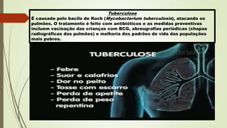 Tuberculose
É causada pelo bacilo de Koch (Mycobacterium tuberculosis), atacando os
pulmões. O tratamento é feito com antibióticos e as medidas preventivas
incluem vacinação das crianças com BCG, abreugrafias periódicas (chapas
radiográficas dos pulmões) e melhoria dos padrões de vida das populações
mais pobres.
 