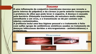 Tracoma
É uma inflamação da conjuntiva (membrana mucosa que reveste a
parte interna da pálpebra) e da córnea (a parte anterior transparente
e protetora do olho) que pode levar à cegueira. A doença é causada
pela bactéria Chlamydia trachomatis, de estrutura muito simples,
semelhante a um vírus, e a transmissão se dá por contato com
objetos contaminados.
A profilaxia inclui uma boa higiene pessoal e o tratamento é feito
com sulfas (grupo de antibióticos sintéticos usados no tratamento de
doenças infecciosas devidas a microrganismos - antimicrobianos) e
antibióticos.
 