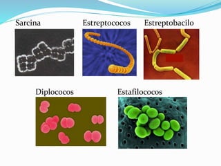 Sarcina Estreptococos Estreptobacilo
Diplococos Estafilococos
 
