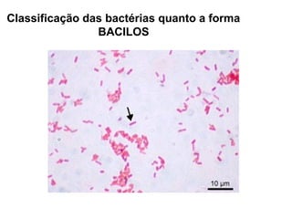 Classificação das bactérias quanto a forma
BACILOS

 