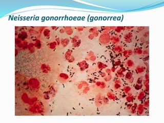 Neisseria gonorrhoeae (gonorrea)
 