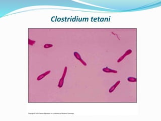 Clostridium tetani
 
