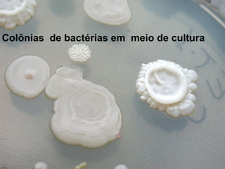 Colônias de bactérias em meio de cultura
 