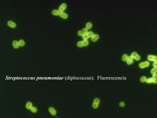Streptococcus pneumoniae (diplococcus). Fluorescencia
 