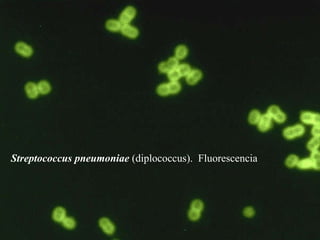 Streptococcus pneumoniae  (diplococcus).  Fluorescencia  