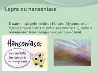 Lepra ou hanseníase

 É transmitida pelo bacilo de Hansen (Mycobacterium
 leprae) e causa lesões na pele e nas mucosas. Quando o
 tratamento é feito a tempo a recuperação é total.
 