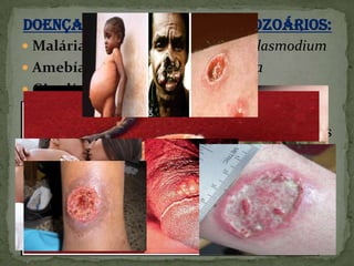 Doenças Causadas por Protozoários:
 Malária;- Protozoários do gênero Plasmodium
 Amebíase;- Entamoeba histolytica
 Giardíase;- Giardia lamblia
 Tricomoníase;- Trichomonas vaginalis
 leishmaniose tegumentar;- Os protozoários
 do gênero Leishmania
 