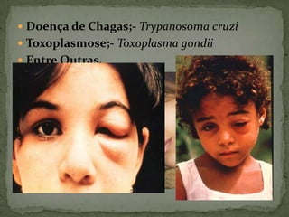  Doença de Chagas;- Trypanosoma cruzi
 Toxoplasmose;- Toxoplasma gondii
 Entre Outras.
 