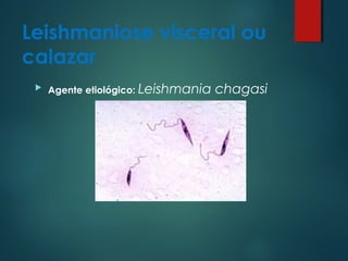 Leishmaniose visceral ou
calazar
 Agente etiológico: Leishmania chagasi
 