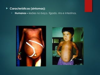  Características (sintomas):
 Humanos – lesões no baço, fígado, rins e intestinos.
 