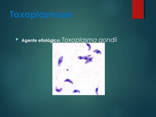 Toxoplasmose
 Agente etiológico: Toxoplasma gondii
 